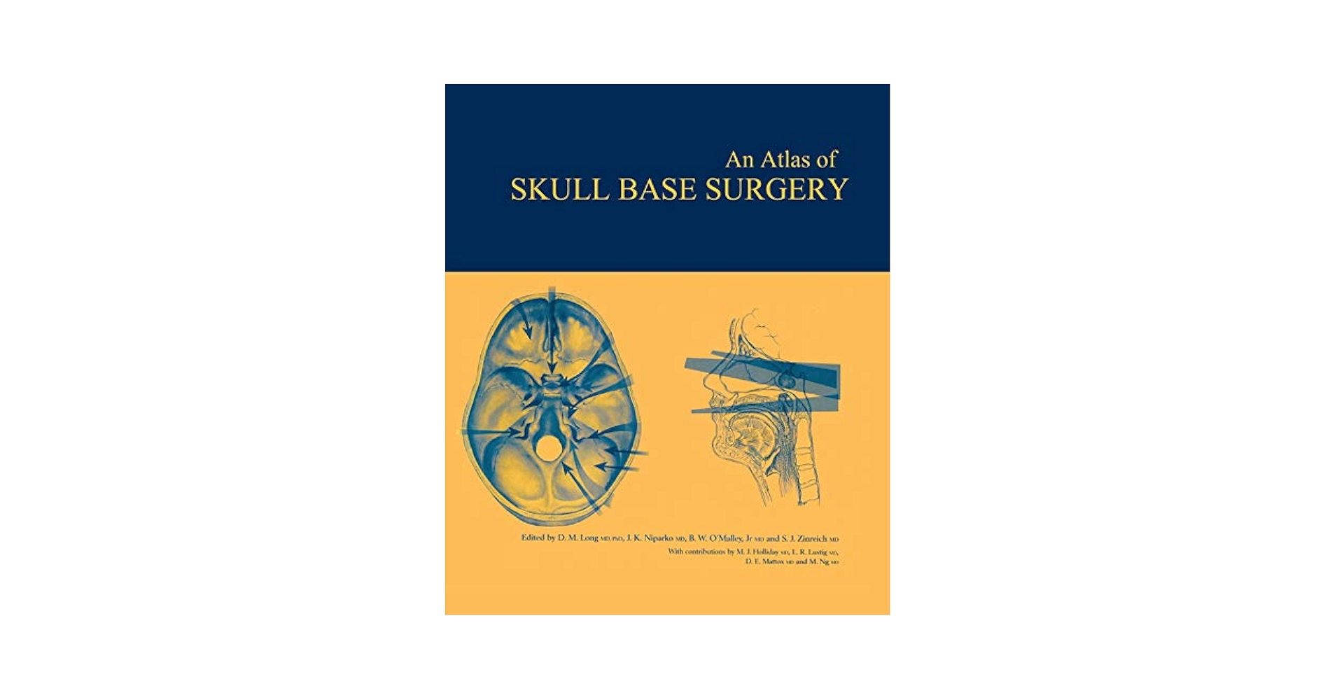 【裁断済み】Handbook of Skull Base Surgery Comprehensive Management of Skull Base Tumors, 2nd edn - The